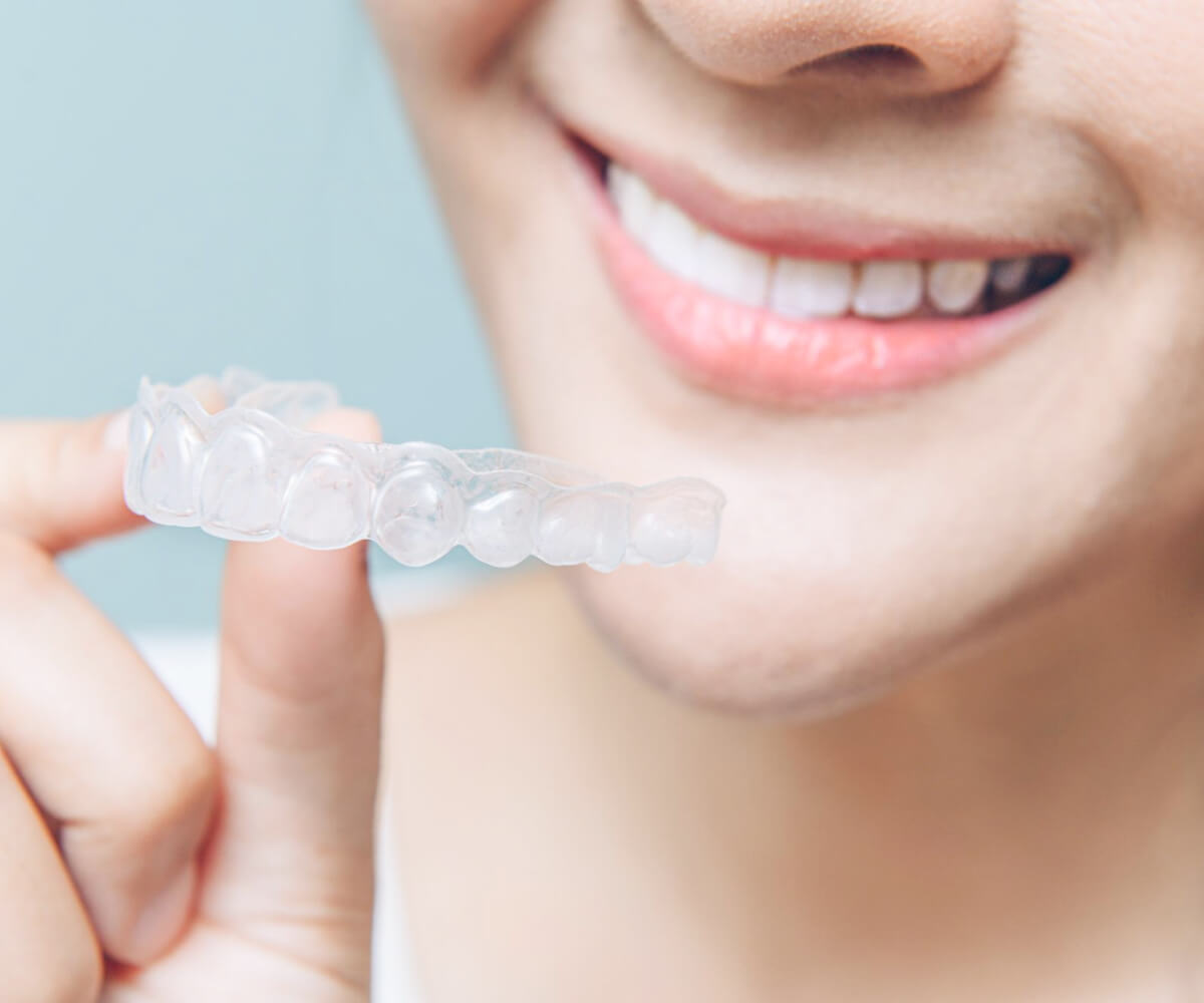 ホームホワイトニング